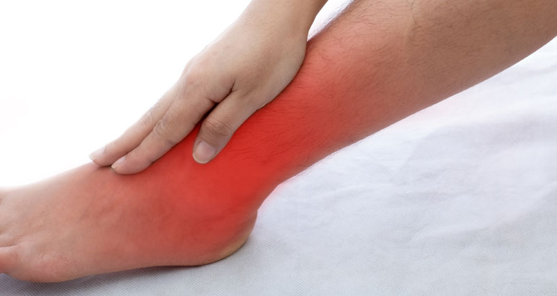 leg with red representing burning feeling