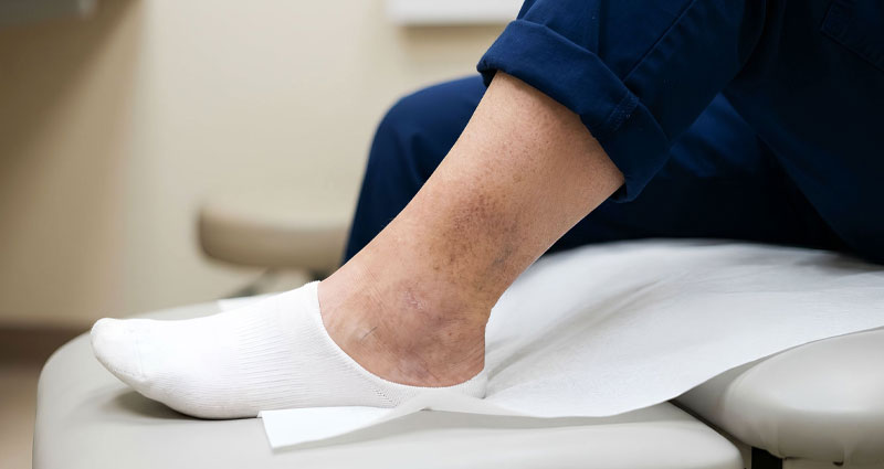 leg with discoloration